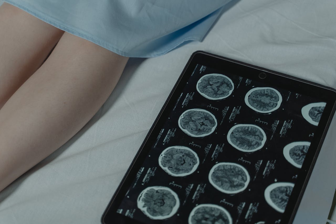 stats-img Close-up of brain CT scan display on tablet beside patient's legs in a hospital room.